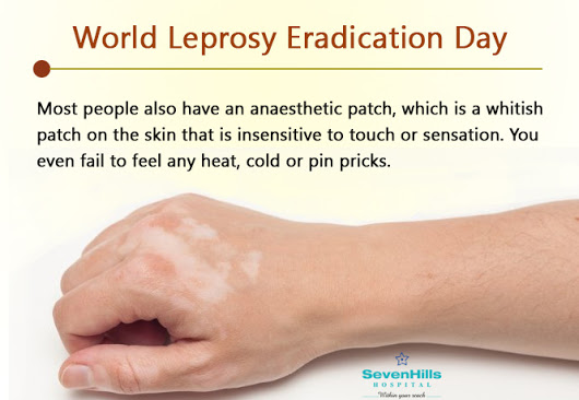 World Leprosy Eradication Day information