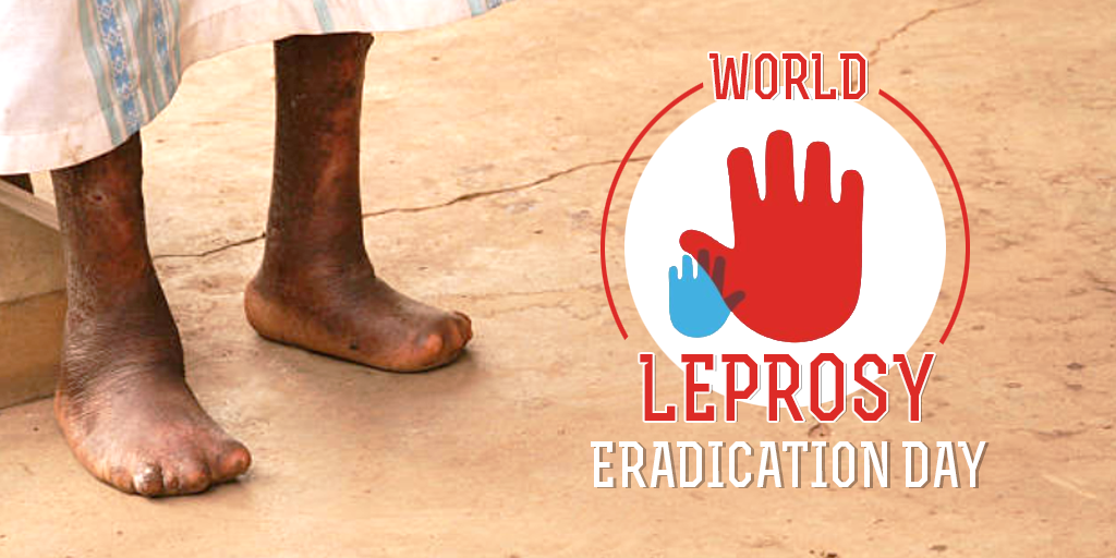 World Leprosy Eradication Day